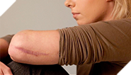 Slip and fall injuries are the most common cause of hospitalization in Canada.
